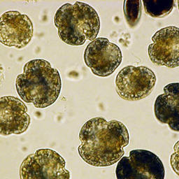 Цветущие токсичные водоросли под микроскопом. Фото пресс-службы Sernapesca