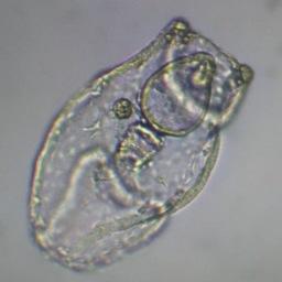 Личинка трепанга под микроскопом. Фото пресс-службы ТИНРО