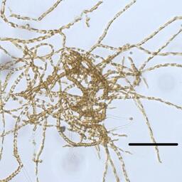 Laminariocolax aecidioides. Фото пресс-службы ННЦМБ ДВО РАН