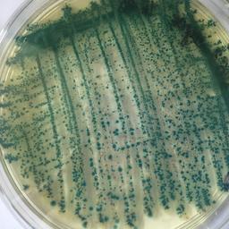 Посев биоматериала для бактериологического исследования с использованием хромогенных питательных сред. Фото пресс-службы АзНИИРХ