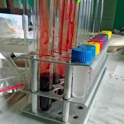 Кровь пиленгаса доставили в лабораторию. Фото пресс-службы АзНИИРХ